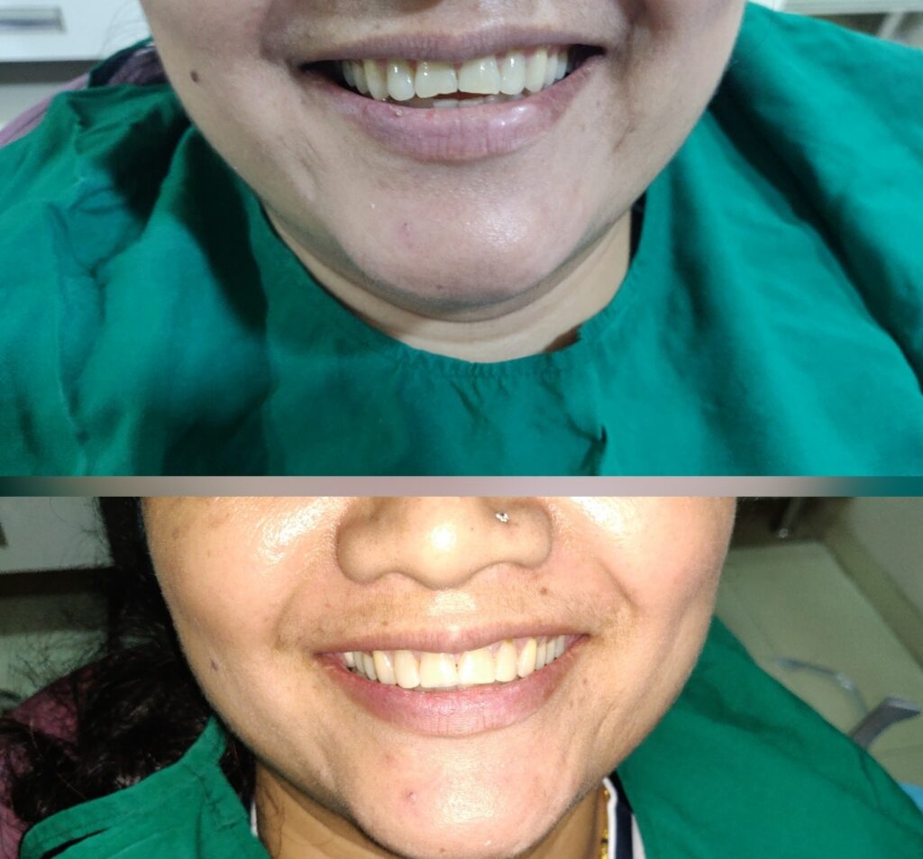 smile makeover testimonials