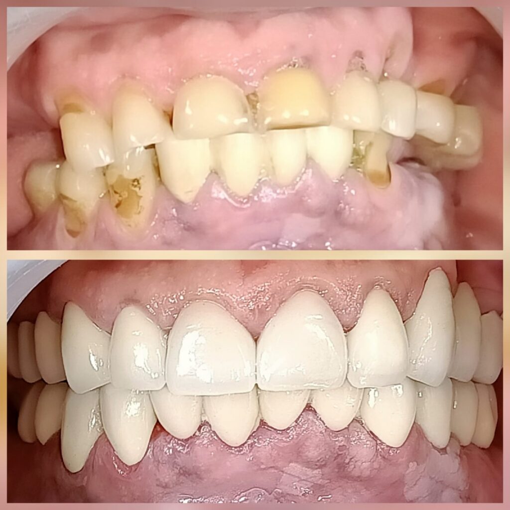 Braces treatment reviews