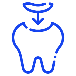 Root Canal Treatment