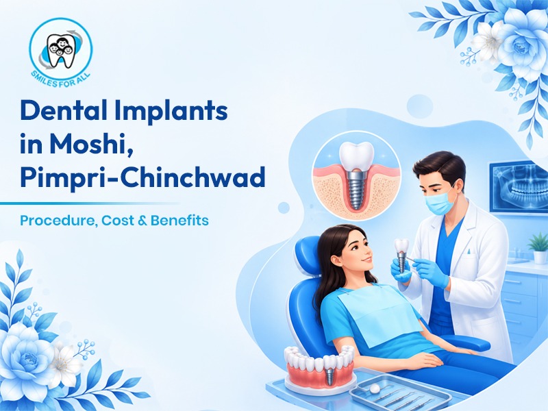 Dental implants in Moshi